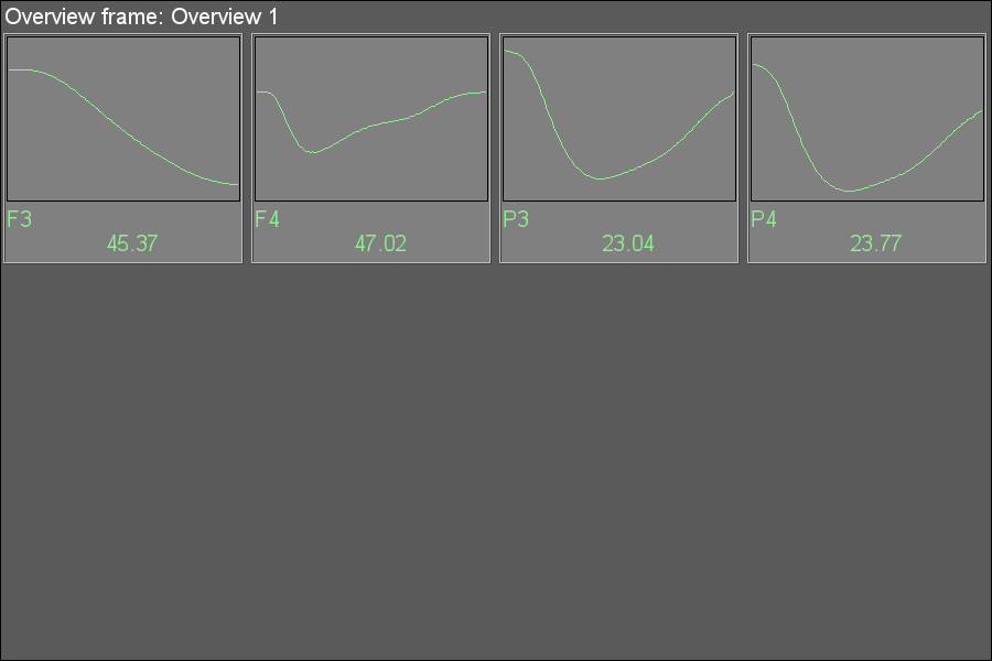 Group of the overview frames "Overview 1". (11 Kb)